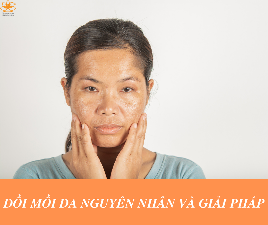 TĂNG SẮC TỐ DA VÀ NGUYÊN NHÂN ĐỒI MỒI TRÊN DA
